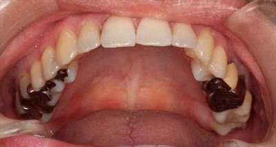 IMG_9586_R21.JPG