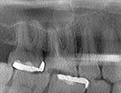 CT_20160630210711_R22.jpg