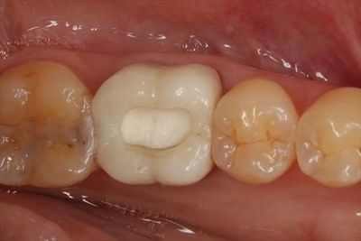 IMG_8559_R22.JPG