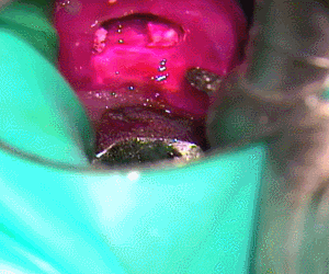 検知液で染まった部分の確認2016.06.03.gif