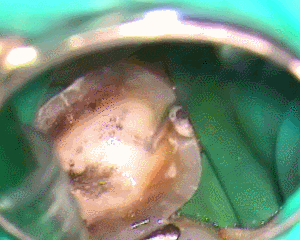 薬液洗浄2016.06.30.gif