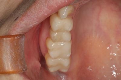 IMG_5590_R22.JPG