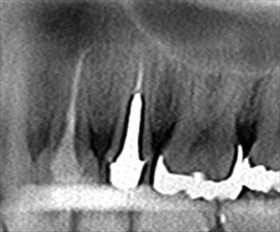 CT_201610272231331_R22.jpg