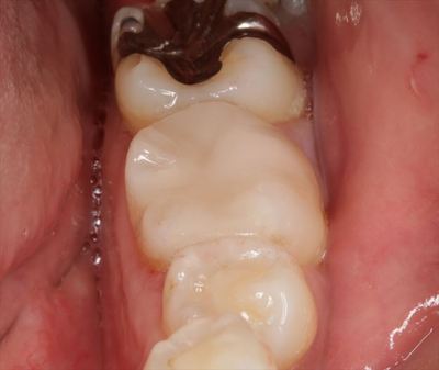 IMG_7360_R22.JPG