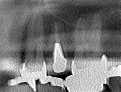 CT_20170114183533_R23.jpg