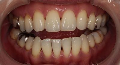 IMG_4615_R23.JPG