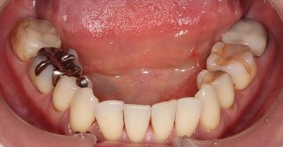 IMG_4619_R23.JPG