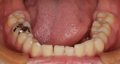 IMG_4008_R23.JPG