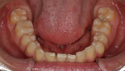 IMG_7377_R23.JPG