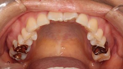 IMG_62fsd48_R23.JPG