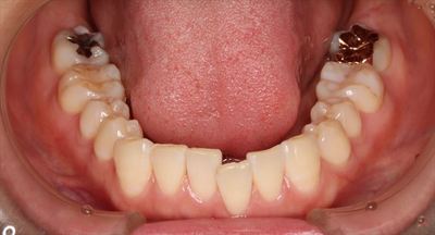 IMG_62fsfs49_R23.JPG
