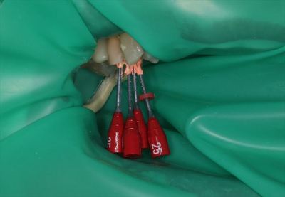 IMG_2969_R25.JPG