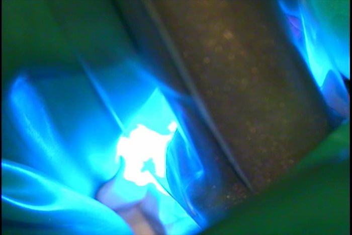 イエローフィルターでブルー波長をカットした上でボンディング材による接着処理をしたあとに光照射機で重合硬化させている写真
