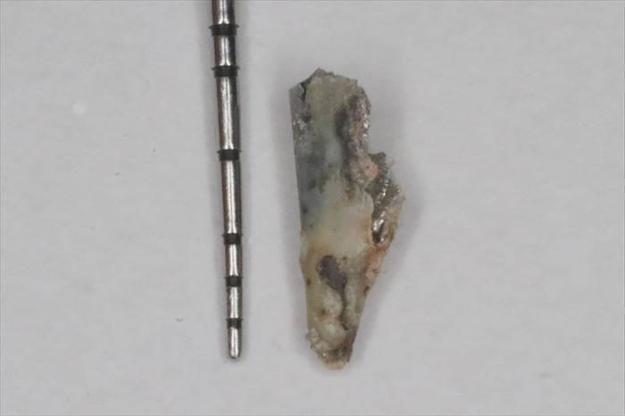 歯から除去した全長約7mmのメタルコアの写真